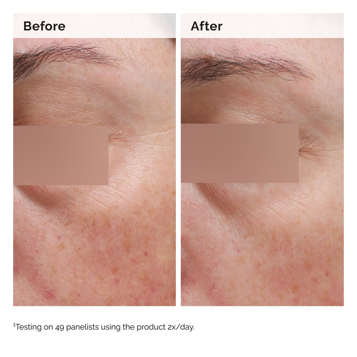 niacinamide-5-face-and-body-emulsion-b8 2024-08-23-ORD-Nia-5pct-Face-Body-B-A-Elasticity-Global-02-1x1.jpg