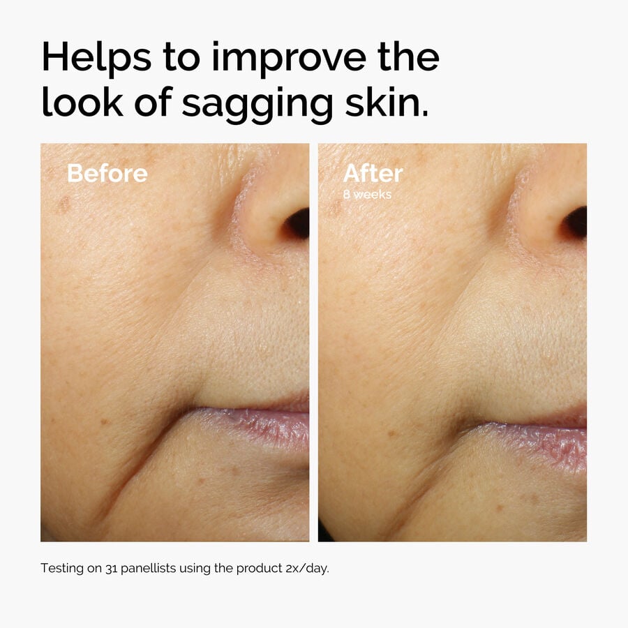 caffeine-3-escin-1-face-serum-t1 ord-caffeine-3pct-escin-1pct-face-serum-before-after-sagging.jpg