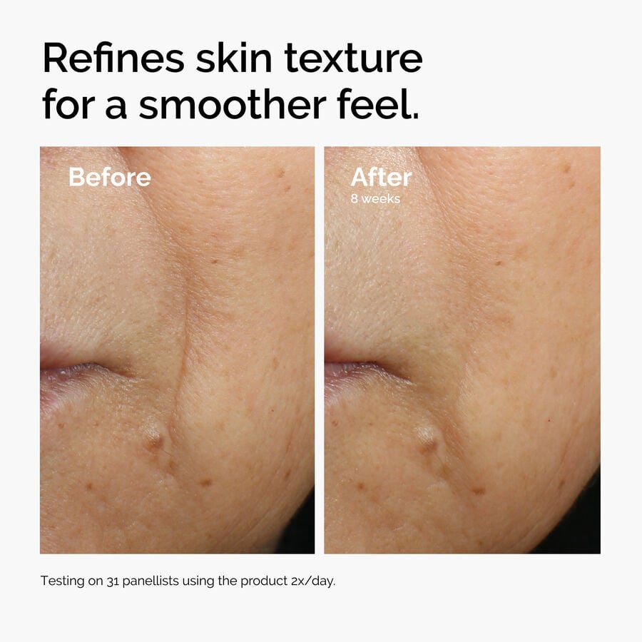 caffeine-3-escin-1-face-serum-t1 ord-caffeine-3pct-escin-1pct-face-serum-before-after-texture.jpg