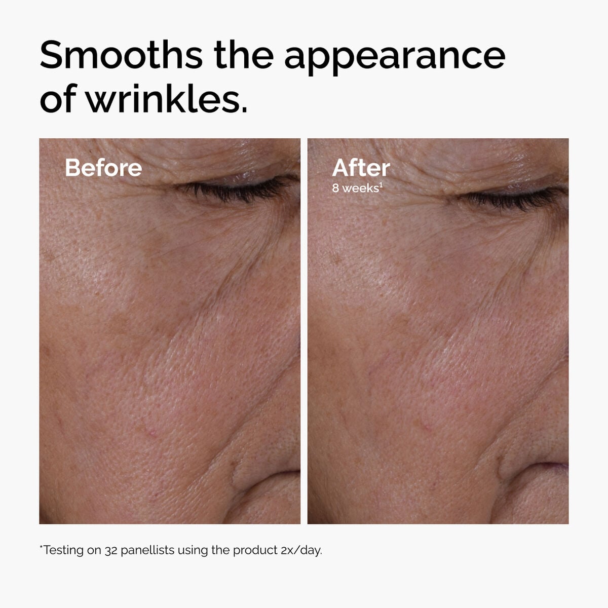 multi-peptide-ha-serum-b5 ord-multi-peptide-ha-serum-wrinkles-before-after.jpg