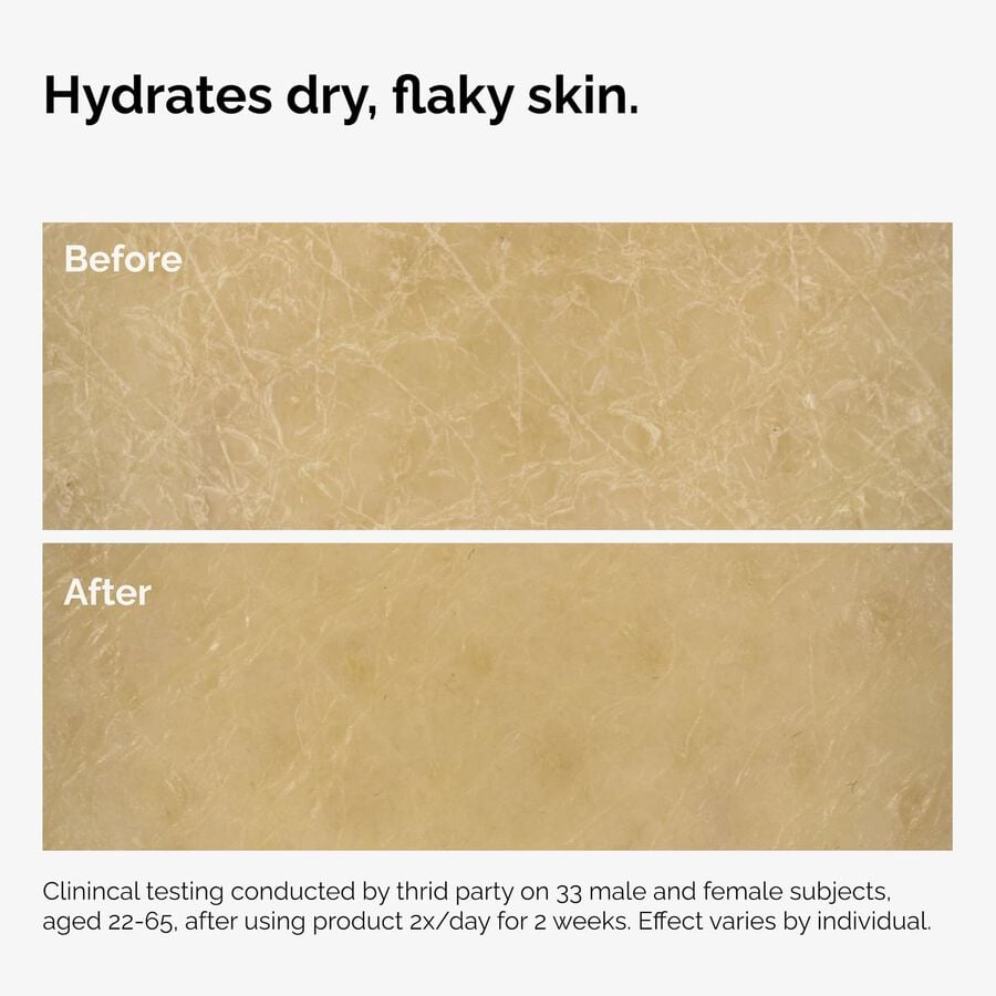 the-body-care-collection-n9 ord-natural-moisturizing-factors-inulin-body-before-after-graphic-02.jpg