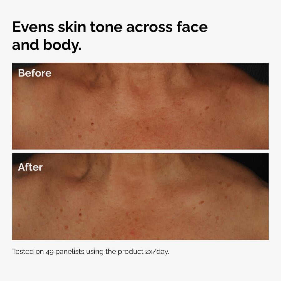 the-body-care-collection-n9 ord-niacinamide-face-body-serum-before-after-even-tone-graphic.jpg