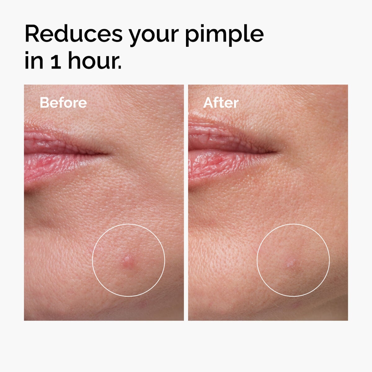 sulfur-10-powder-to-cream-concentrate-r8 ord-sulfur-10pct-powder-to-cream-concentrate-before-after-NA.jpg